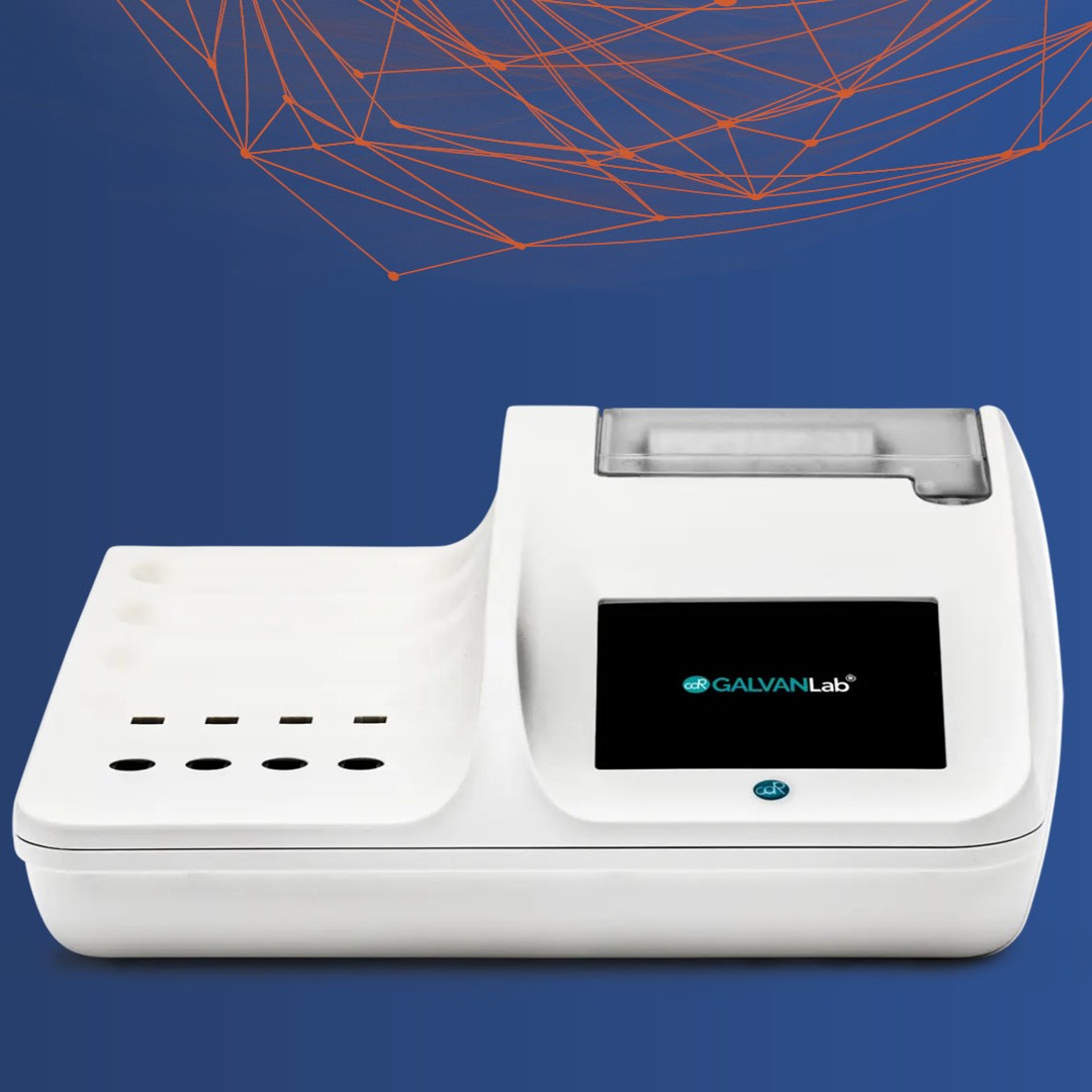 CDR GalvanLab®: Innovation in electroplating bath quality control ...